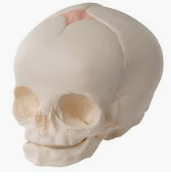 foetal skull its diameters Sutures and Fontanelle