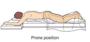 Prone Position Examples Patient Positioning: Importance, Techniques, and Safety Considerations ...