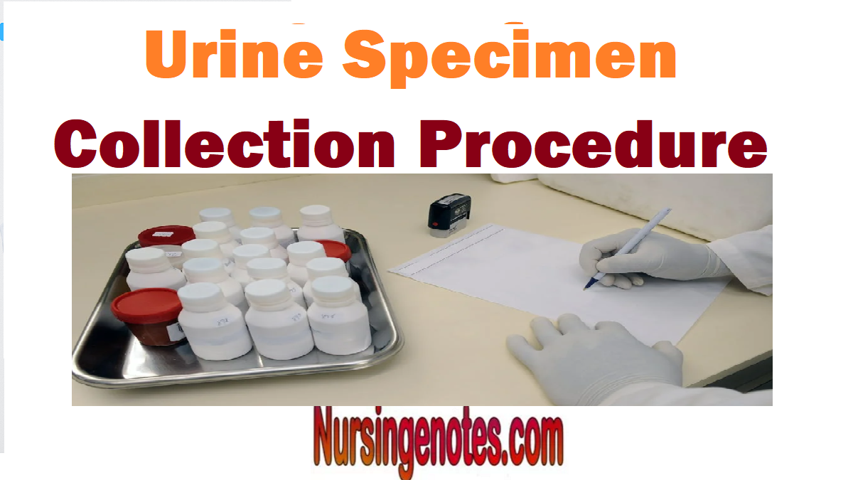 Urine Specimen Collection Procedure Male Female And Infants 