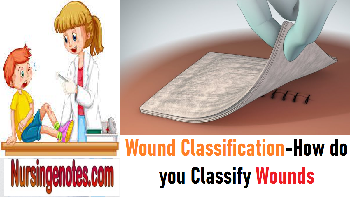 Wound ClassificationHow do you Classify Wounds . NursingNotes