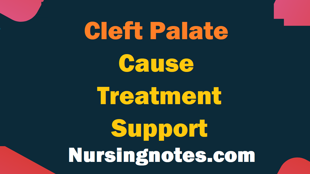 What Is the Cause of Cleft Palate? NursingNotes