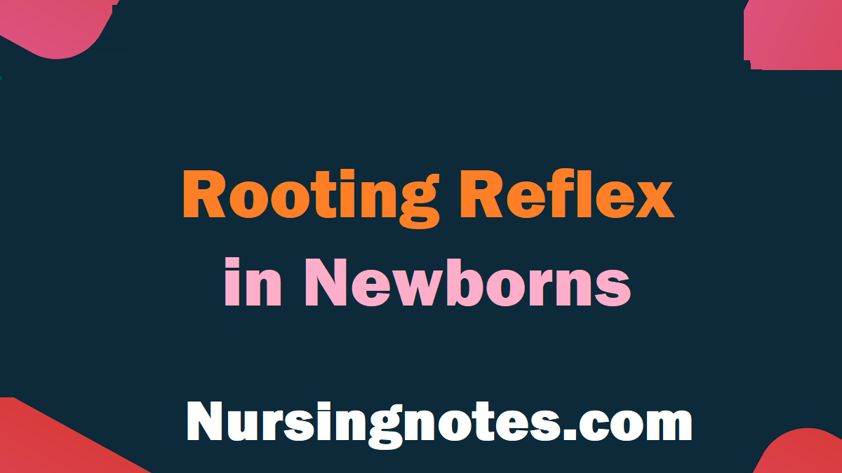 What Is The Rooting Reflex In Newborns? - NursingNotes