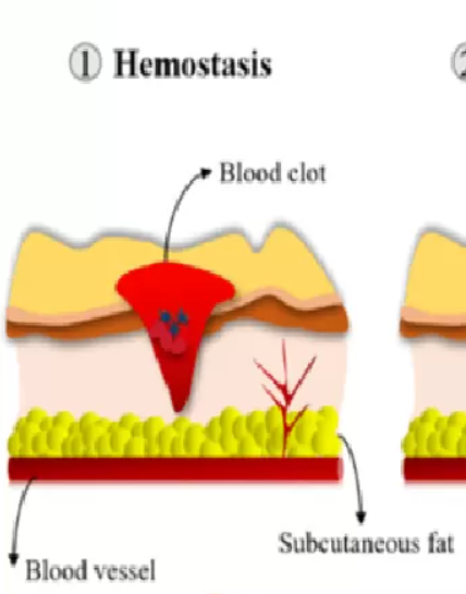 The Four Phases Of Wound Healing: A Guide To The Wound Healing Process ...